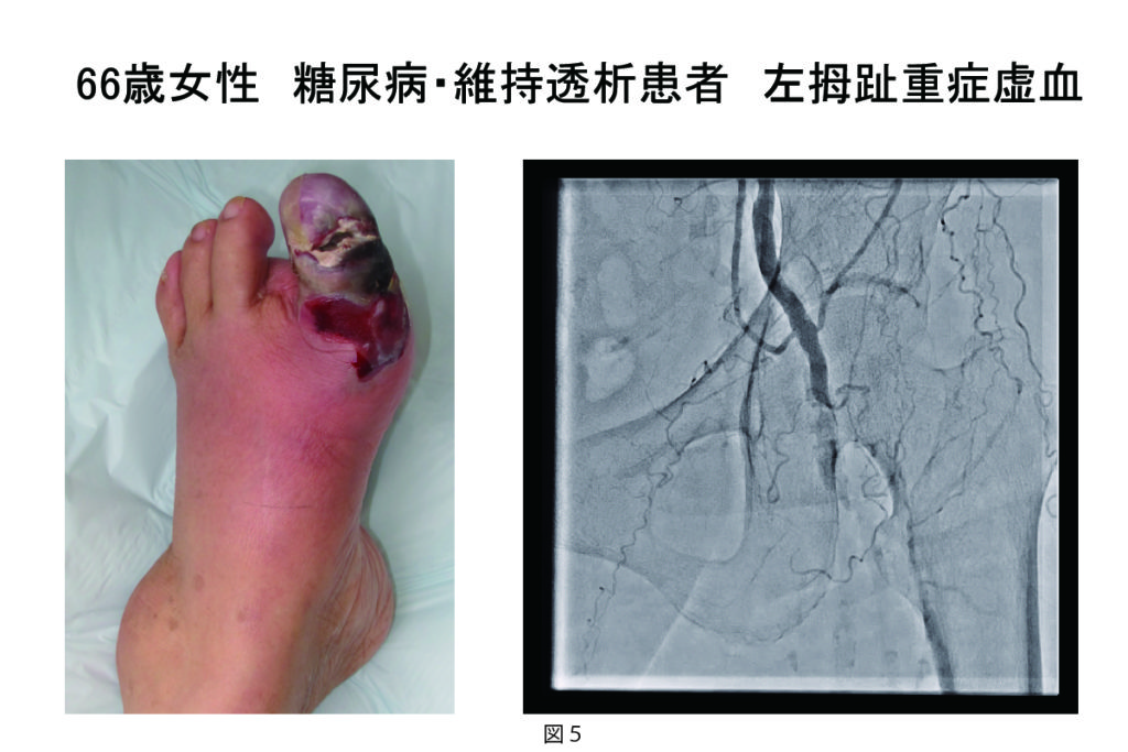 plastic_surgery004