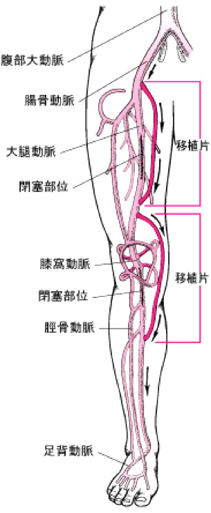 Artery 岐阜ハートセンター