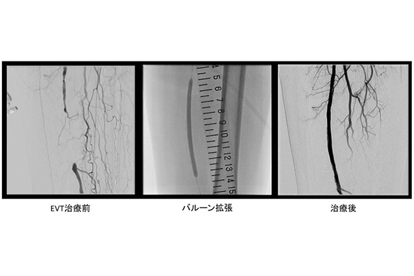 outpatient_peripheral04