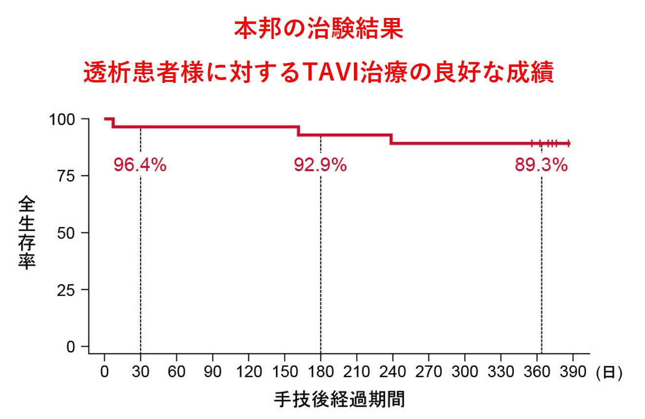 大動脈弁狭窄症に対するカテーテル治療(TAVI) – 岐阜ハートセンター